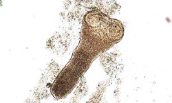 Hymenolepis nana